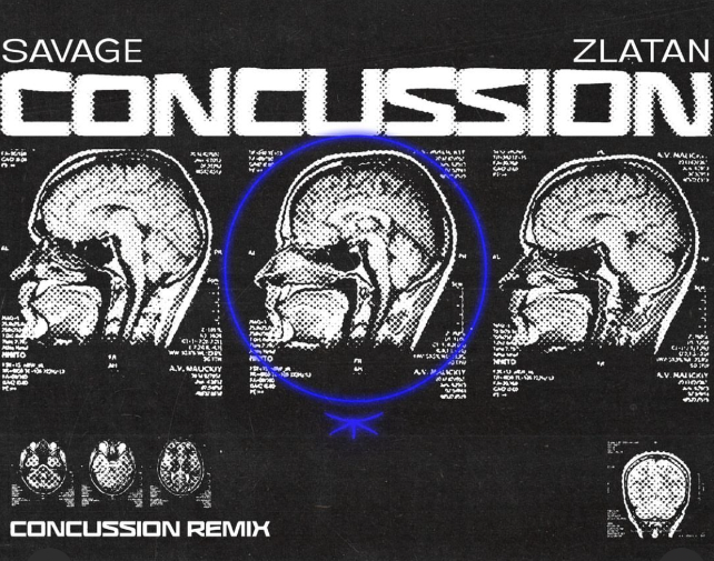 Savage – Concussion (Remix) Ft. Zlatan